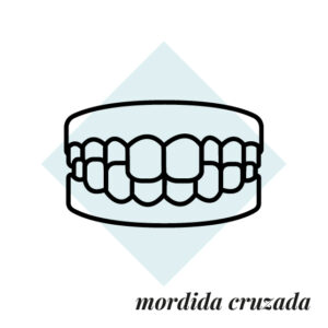 mordida cruzada