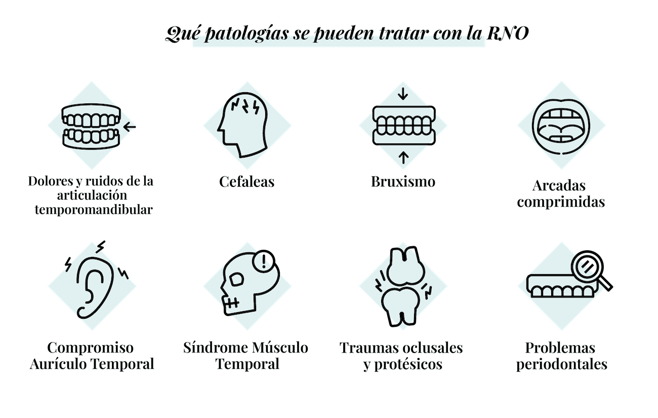 patologias tratamiento Rehabilitacion neuro-oclusal dentisana clinica dental ruzafa valencia