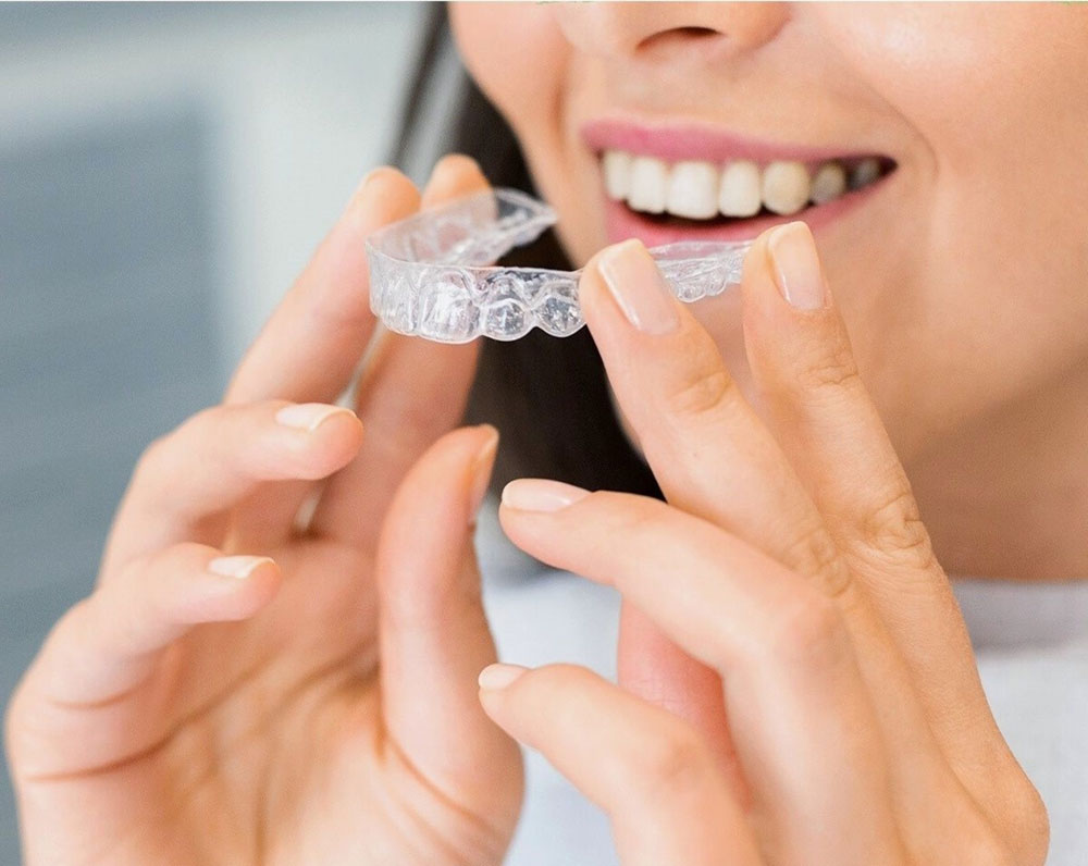 Opiniones REALES de la ortodoncia Invisible | Opiniones Invisalign™