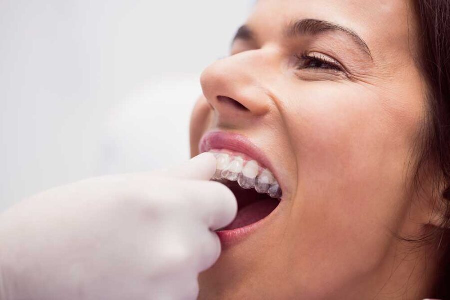 6 mejores marcas ortodoncia invisible clinica dental dentisana ruzafa valencia