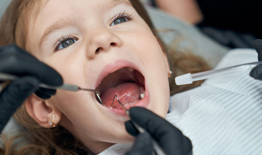 caries en dientes de leche causas sintomas y tratamiento dentisana clinica dental en ruzafa valencia