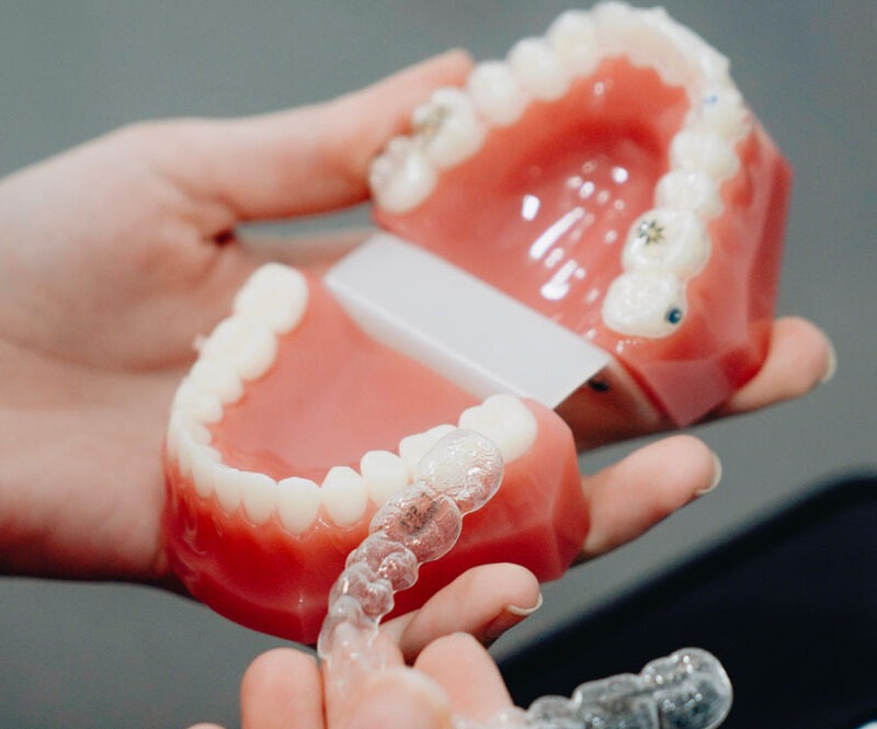 ortodoncia invisible o lingual dentisana clinica dental en ruzafa valencia