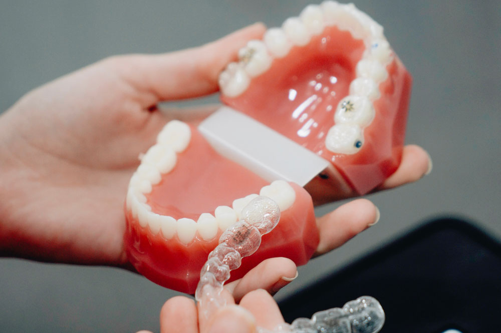 ortodoncia invisible o lingual dentisana clinica dental en ruzafa valencia